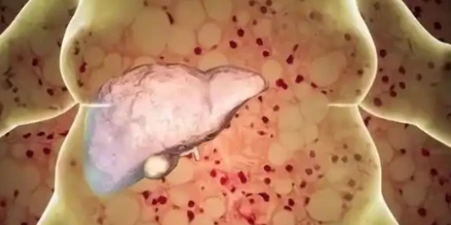 5-Amino-1MQ Adipose Tissue Remodeling | Shaanxi BLOOM Tech Co., Ltd 5-Amino-1MQ Adipose Tissue Remodeling | Shaanxi BLOOM Tech Co., Ltd