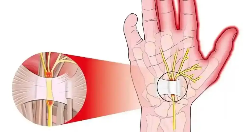 Ziconotide precise | Shaanxi BLOOM Tech Co., Ltd Ziconotide precise | Shaanxi BLOOM Tech Co., Ltd