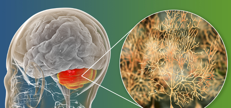 Ziconotide effect | Shaanxi BLOOM Tech Co., Ltd Ziconotide effect | Shaanxi BLOOM Tech Co., Ltd